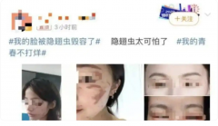 近期注意：这种小飞虫是“飞行的硫酸”！看见千万别用手拍