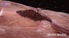 身体这7个变化，可能是体内有肿瘤了